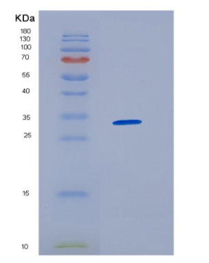 Recombinant Human HNRNPAB Protein,Recombinant Human HNRNPAB Protein