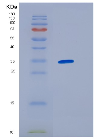 Recombinant Human HNRNPC Protein,Recombinant Human HNRNPC Protein