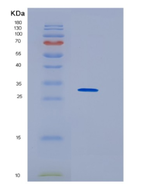 Recombinant Human HNRNPK Protein,Recombinant Human HNRNPK Protein