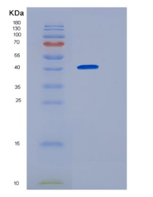 Recombinant Human Homer 1 Protein,Recombinant Human Homer 1 Protein