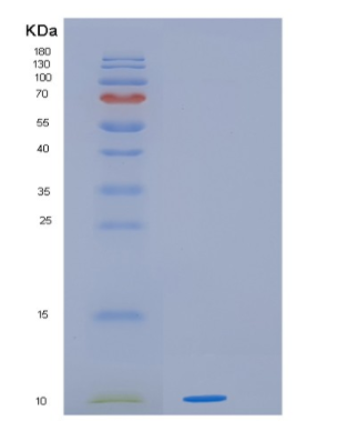 Recombinant Human HOPX Protein,Recombinant Human HOPX Protein