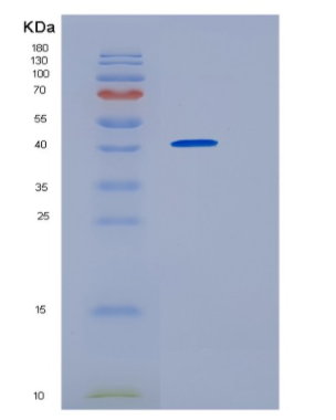 Recombinant Human HOMER2 Protein,Recombinant Human HOMER2 Protein