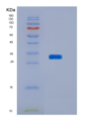 Recombinant Human HOXA9 Protein,Recombinant Human HOXA9 Protein