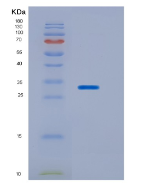 Recombinant Human HOXB13 Protein,Recombinant Human HOXB13 Protein