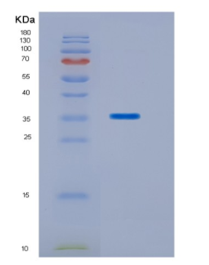 Recombinant Human HOXC11 Protein,Recombinant Human HOXC11 Protein