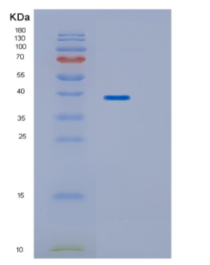 Recombinant Human HP Protein,Recombinant Human HP Protein