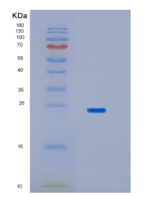 Recombinant Human HPCAL1 Protein,Recombinant Human HPCAL1 Protein