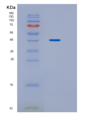 Recombinant Human HPD Protein,Recombinant Human HPD Protein