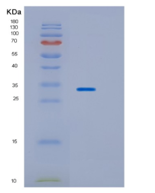 Recombinant Human HPGD Protein,Recombinant Human HPGD Protein