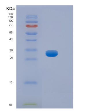 Recombinant Mouse Hpgd Protein,Recombinant Mouse Hpgd Protein