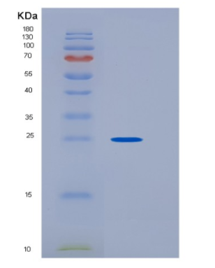 Recombinant Human HPGDS Protein,Recombinant Human HPGDS Protein