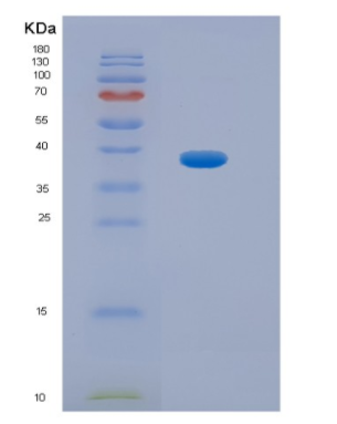 Recombinant Human HPR Protein,Recombinant Human HPR Protein