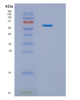 Recombinant Human HPSE Protein,Recombinant Human HPSE Protein