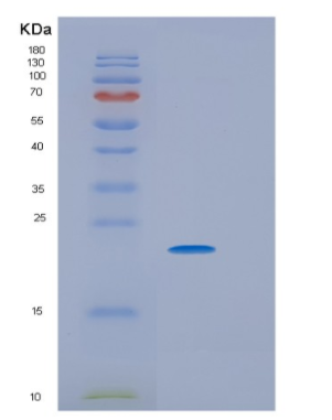 Recombinant Human HRAS Protein,Recombinant Human HRAS Protein