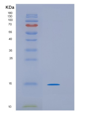 Recombinant Human HRAS-like suppressor3 Protein,Recombinant Human HRAS-like suppressor3 Protein