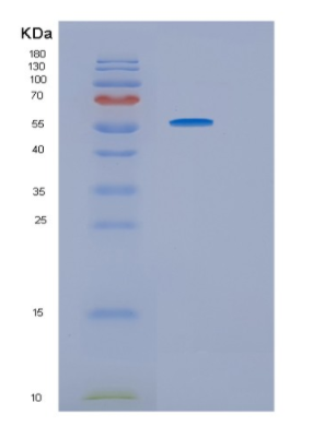 Recombinant Human HRS (Histidyl-tRNA synthetase) Protein,Recombinant Human HRS (Histidyl-tRNA synthetase) Protein