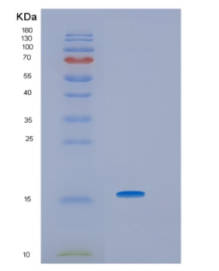 Recombinant Human HRSP12 Protein,Recombinant Human HRSP12 Protein