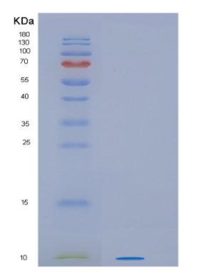 Recombinant Human HSBP1L1 Protein,Recombinant Human HSBP1L1 Protein