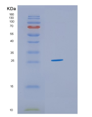 Recombinant Human HSCB Protein,Recombinant Human HSCB Protein