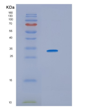 Recombinant Human HSD17B10 Protein,Recombinant Human HSD17B10 Protein