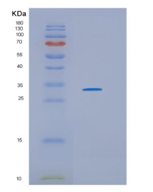 Recombinant Human HSD17B11 Protein,Recombinant Human HSD17B11 Protein