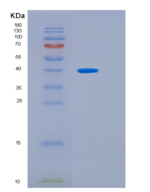 Recombinant Human HSF2BP Protein,Recombinant Human HSF2BP Protein