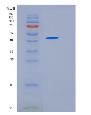 Recombinant Human HSFY1 Protein,Recombinant Human HSFY1 Protein