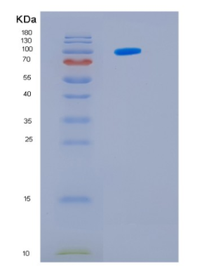 Recombinant E.coli Hsp104(amino acids 1-908) Saccharomyces cerevisiae Protein,Recombinant E.coli Hsp104(amino acids 1-908) Saccharomyces cerevisiae Protein