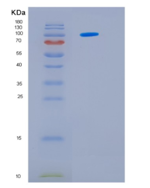 Recombinant Human HSP105α 1-858 aa Protein,Recombinant Human HSP105α 1-858 aa Protein