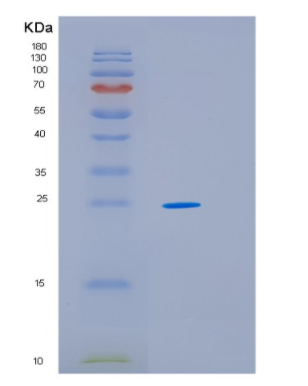 Recombinant Human HSP27 Protein,Recombinant Human HSP27 Protein