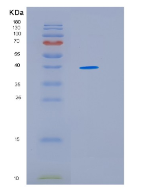 Recombinant Human HSP40(DNAJ) Human Protein,Recombinant Human HSP40(DNAJ) Human Protein