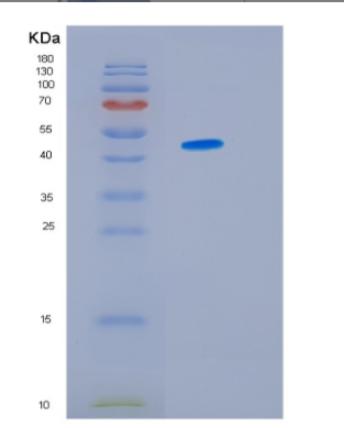 Recombinant Human HSP47(Colligin) Protein,Recombinant Human HSP47(Colligin) Protein