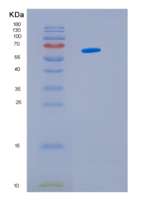 Recombinant Human HSP60 Protein,Recombinant Human HSP60 Protein