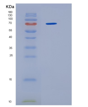 Recombinant Human HSP70 (amino acids 1-641) Human Protein,Recombinant Human HSP70 (amino acids 1-641) Human Protein