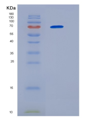 Recombinant Human HSP70B Protein,Recombinant Human HSP70B Protein