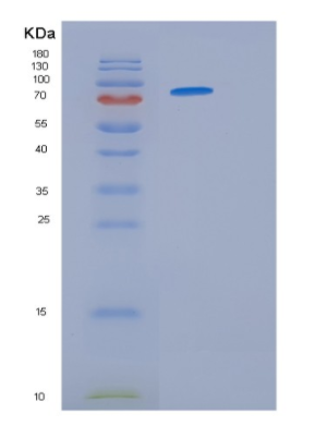 Recombinant Human HSP90 (amino acids 1-732) Protein,Recombinant Human HSP90 (amino acids 1-732) Protein