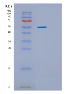 Recombinant Human HSPA13 Protein,Recombinant Human HSPA13 Protein