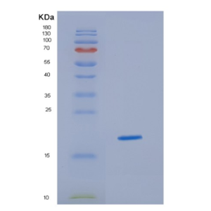 Recombinant Human HBA2 Protein,Recombinant Human HBA2 Protein