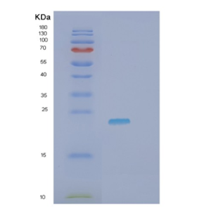 Recombinant Human HAVCR2 Protein,Recombinant Human HAVCR2 Protein