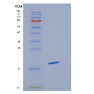 Recombinant Human HBG1 Protein,Recombinant Human HBG1 Protein