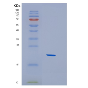 Recombinant Human HBXIP Protein,Recombinant Human HBXIP Protein