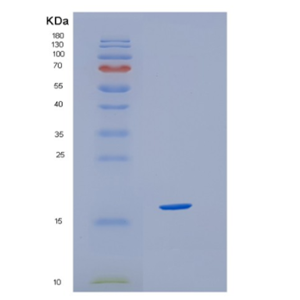 Recombinant Human HBQ1 Protein,Recombinant Human HBQ1 Protein