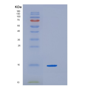 Recombinant Hepatitis C virusHCV-Core Protein,Recombinant Hepatitis C virusHCV-Core Protein