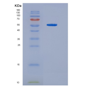 Recombinant Human HDAC2 Protein,Recombinant Human HDAC2 Protein