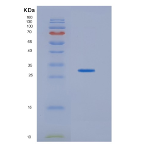 Recombinant Human HDHD2 Protein