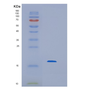 Recombinant Human HBG2 Protein