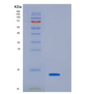 Recombinant Hepatitis C Virus HCV-NS5a Protein,Recombinant Hepatitis C Virus HCV-NS5a Protein