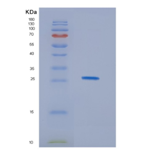 Recombinant Human HDHD1A Protein