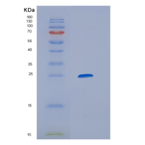 Recombinant Mouse Hepatitis A virus cellular receptor 1 Protein