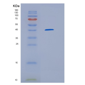 Recombinant Human HERC5 Protein